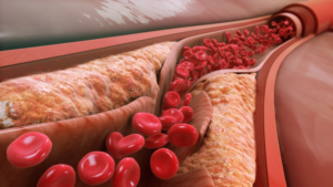 Vitamine K2/D3
